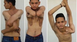 Индийский уникум: юноша научился выворачивать руки и ноги под любым углом (6 фото + 2 видео)