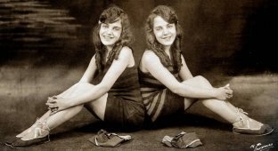 Жизнь сиамских близнецов Дейзи и Виолетты Хилтон (8 фото)