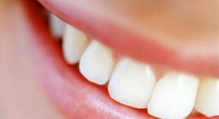 Интересные факты о зубах (9 фото)