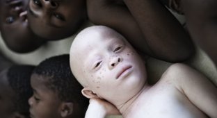 Удивительные портреты альбиносов Танзании, призывающие мир "проснуться" (12 фото)