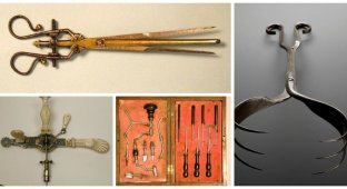 Лечение или пытки: антикварные медицинские инструменты от одного вида которых становится плохо (21 фото)