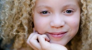 Ава Кларк – 8-летняя девочка-альбинос, ставшая юной афроамериканской моделью (13 фото)