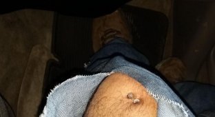 Строитель загнал в колено два гвоздя, но ему повезло (9 фото)