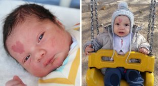 Самое сердечное дитя в мире: в Турции родился младенец с сердечком на лице (4 фото)
