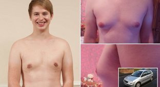 Подросток и проблемы с грудью (5 фото)