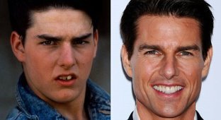 Звезды до и после стоматолога (10 фотографий)