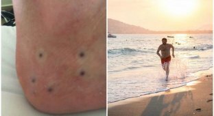 Британец обнаружил странные точки на стопе, и его жестоко затроллили в сети (4 фото)