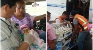 В Боливии девочка родилась с сердцем за пределами грудной клетки (4 фото)