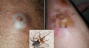 Ядовитые пауки Британии могут сделать человека инвалидом! (7 фото)