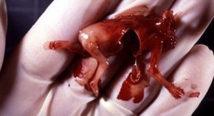 Человеческий эмбрион (27 фото)