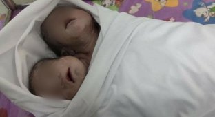 В Азии родился здоровый двуглавый малыш (4 фото)