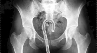 Даже врачи не сразу поверили в то, что увидели на этих рентгеновских снимках! (17 фото)