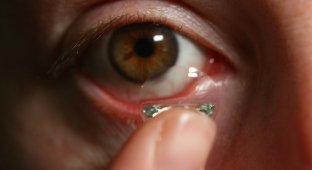 27 линз в глазах: шокирующая находка британских врачей (3 фото)