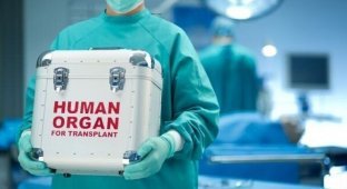 Китайские врачи попались на незаконной продаже органов (4 фото)