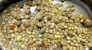 У любителя тофу врачи удалили 420 камней из почек (4 фото + 1 видео)