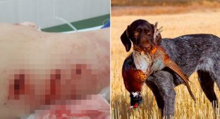 Грызла 20 минут: охотничья собака напала на трехлетнего ребенка прямо на детской площадке (7 фото)