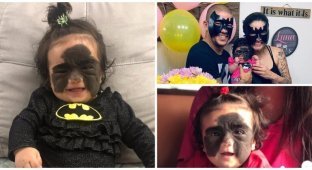 Маленькая американка с родимым пятном в виде «маски Бэтмена» едет лечиться в Россию (6 фото)