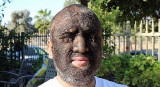 Это самый волосатый мужчина в мире: 98% его тела покрыты густыми темными волосами (5 фото + 1 видео)