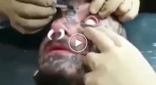 Как проходит татуирование глаза