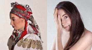 Впечатляющие селфи девушки из Словакии, родившейся с половиной лица (18 фото)