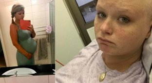 Девушка думала, что беременна и "родила" в туалете раковую опухоль (10 фото)