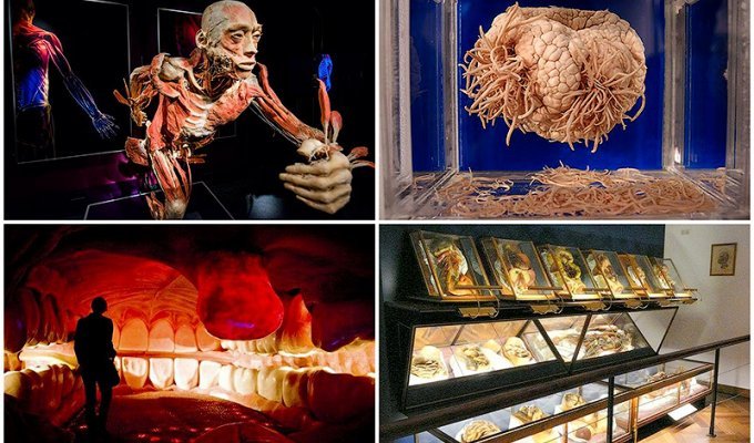 6 самых шокирующих анатомических музеев мира (11 фото)