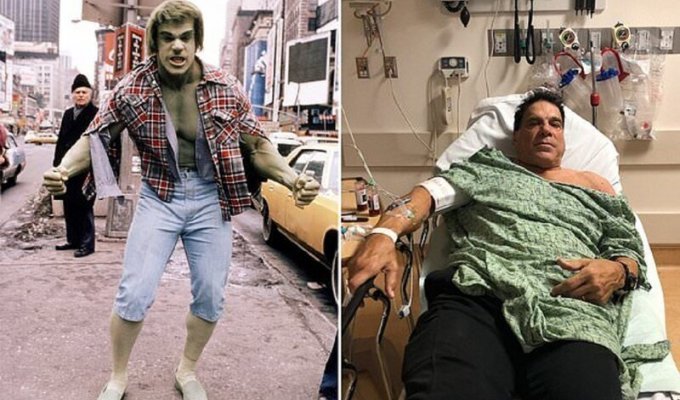 Невероятный Халк попал в госпиталь после неудачной прививки (5 фото)