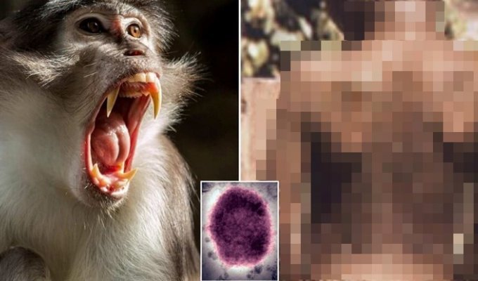 Турист заразился смертельным вирусом в парке обезьян (4 фото)