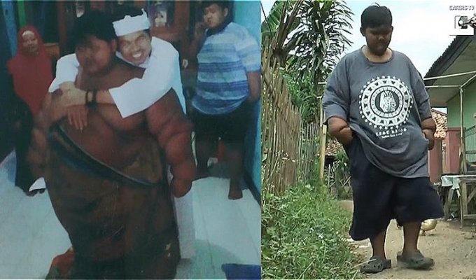 Самый толстый мальчик в мире похудел на 76 кг (6 фото + 2 видео)
