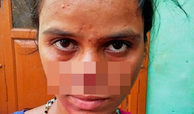 Обидевшись из-за приданного, индиец отрезал жене нос и сбежал с ним (4 фото)
