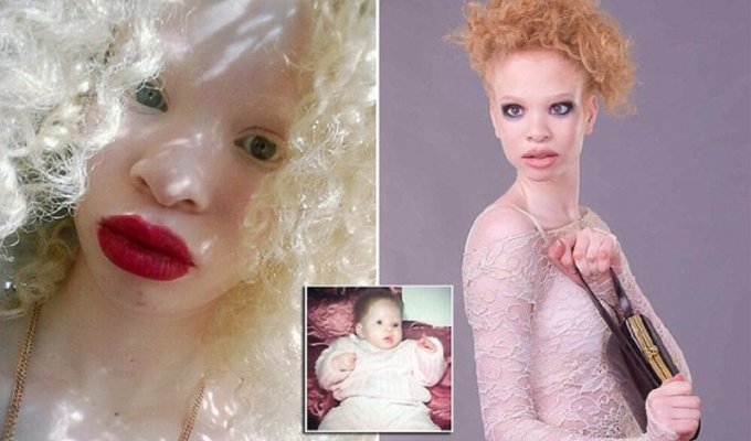 Красавица-альбинос добилась успеха в модельном бизнесе (11 фото)