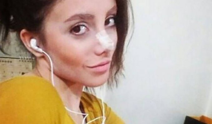 Иранка перенесла 50 операций, чтобы стать похожей на Анджелину Джоли (12 фото)