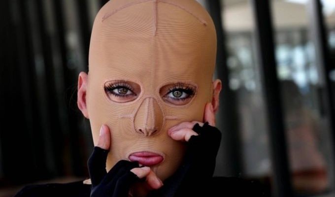 Жизнь без лица закончена: австралийка сняла маску, которую носила 2,5 года (18 фото)