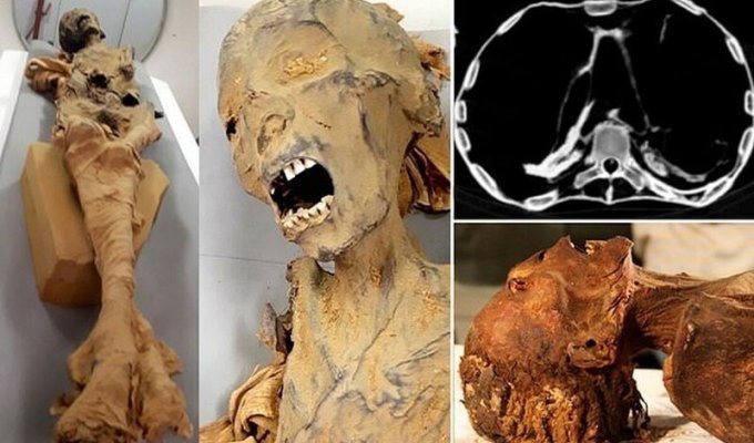 Компьютерная томография объяснила причину смерти "мумии кричащей женщины" (5 фото)