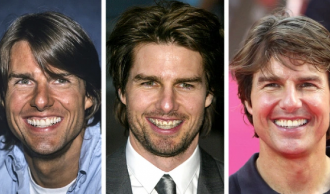 "Цена голливудской улыбки": знаменитости, которые носили брекеты (8 фото)