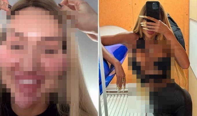 Жертва пластики: 36-летняя девушка вставила себе импланты в лицо (6 фото)