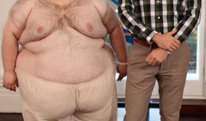 Человек-пончик похудел на 184 килограмма! (13 фото)