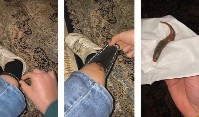 Девушка обнаружила в своем носке громадную пиявку (4 фото + 1 видео)