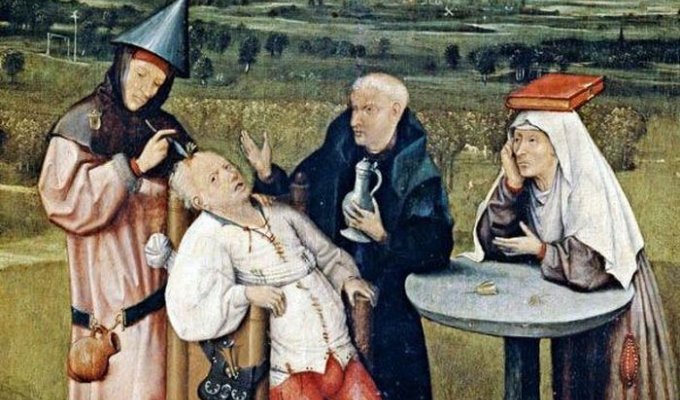 Беспощадная средневековая медицина (16 фото)