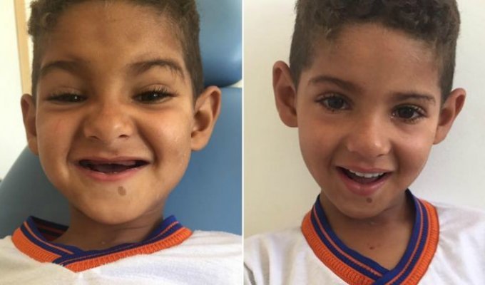 Стоматолог подарила беззубому мальчику новую улыбку (7 фото)