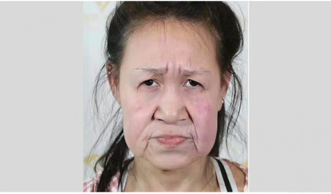 15-летней школьнице с лицом бабушки, сделали пластическую операцию (5 фото)