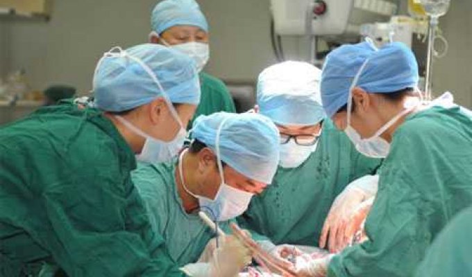 Хирурги 16 часов срезали с мужчины 108-килограммовую родинку (8 фото)