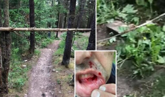 Мужчина получил жуткие травмы, напоровшись на лесной дороге на сучковатое дерево (4 фото)