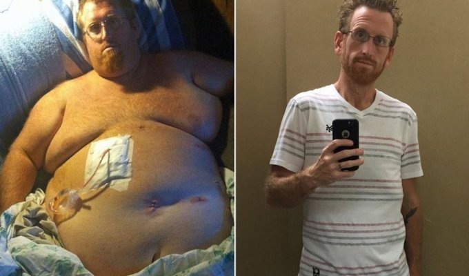 Чтобы не умереть от лишнего веса, американец скинул 160 кг (13 фото + 1 видео)