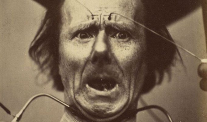 Наука, ты меня пугаешь: как невропатолог Дюшен де Булонь изучал эмоции и мышцы лица в 1862 году (22 фото)