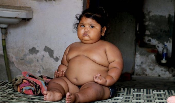 Из-за генной мутации девочку разнесло до невероятных размеров: 25 кг в возрасте 1,4 года (6 фото)