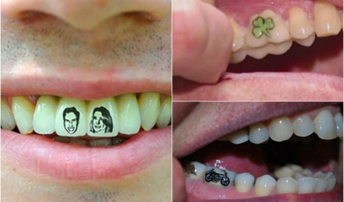 Новый модный трэнд: татуировки на зубах (12 фото)