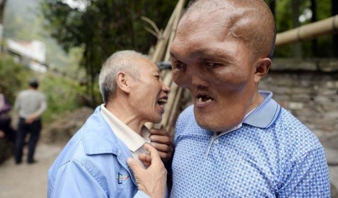 В Китае живет человек с "лицом инопланетянина" (6 фото)