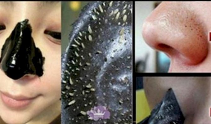 Как быстро убрать черные точки на носу - ликбез для новичков (6 фото)
