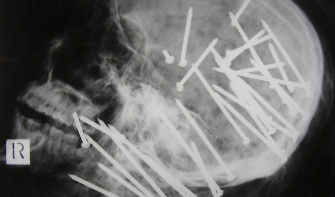 Cамые странные рентгеновские снимки (20 фото)